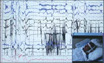 Photo courtesy of Paula Davenport, Kootenai Health