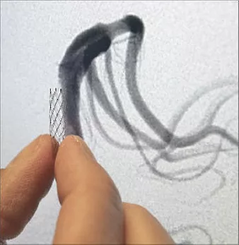 Staff photo by Mike McLean